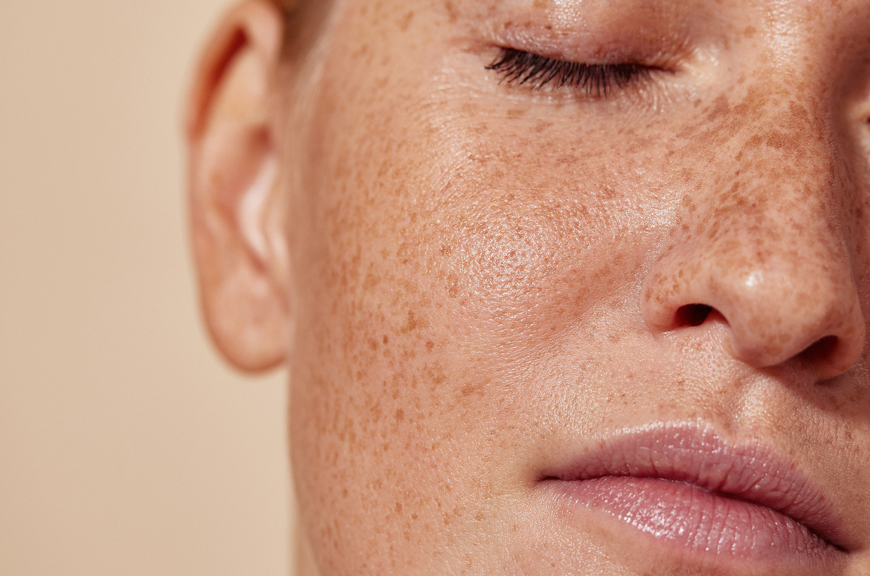 What Is the Skin Barrier, and How Do You Know If Yours Is Broken?